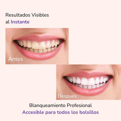 ¡OFERTA 2x1 + REGALO! CREMA BLANQUEADORA MORADA JAYSUING V34 | Edición LaBellaPerfecta